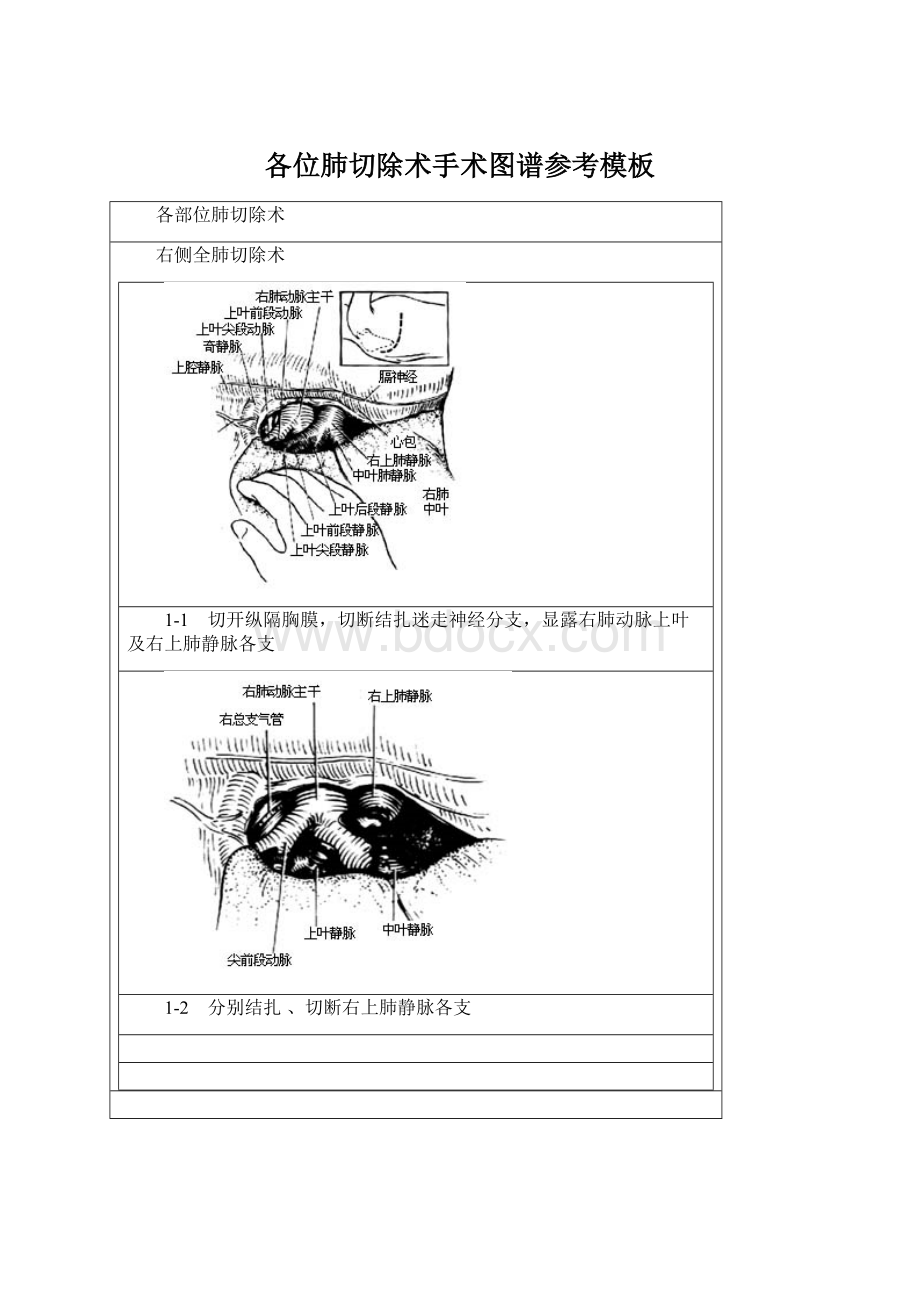 各位肺切除术手术图谱参考模板.docx_第1页