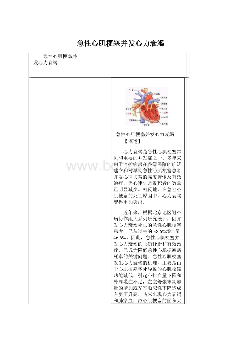 急性心肌梗塞并发心力衰竭Word格式文档下载.docx