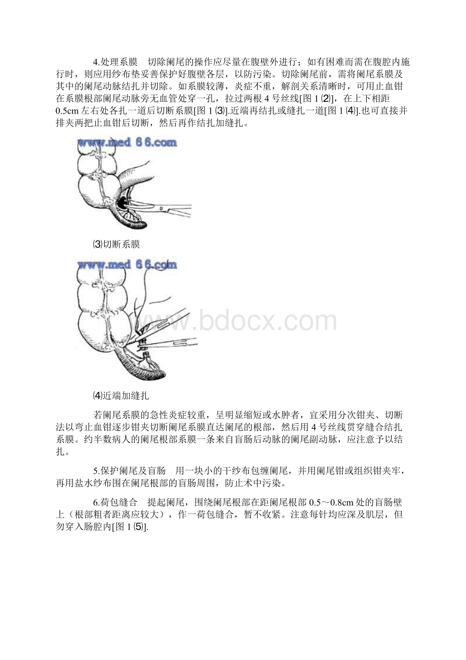 阑尾炎切除术Word格式文档下载.docx_第3页