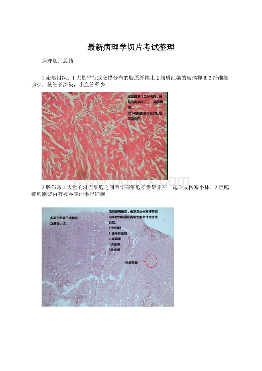 最新病理学切片考试整理.docx_第1页