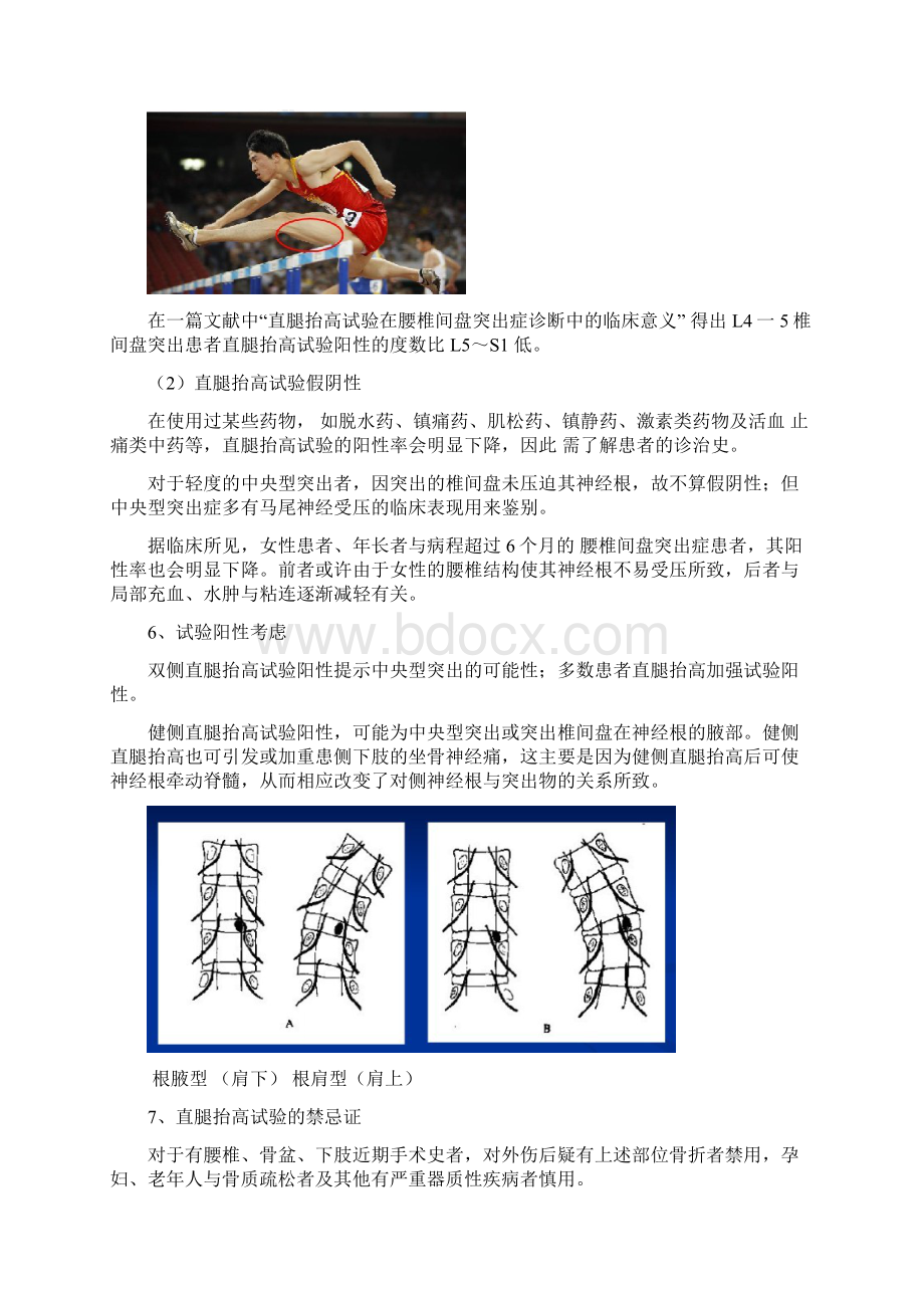 腰突的体格检查Word文件下载.docx_第3页