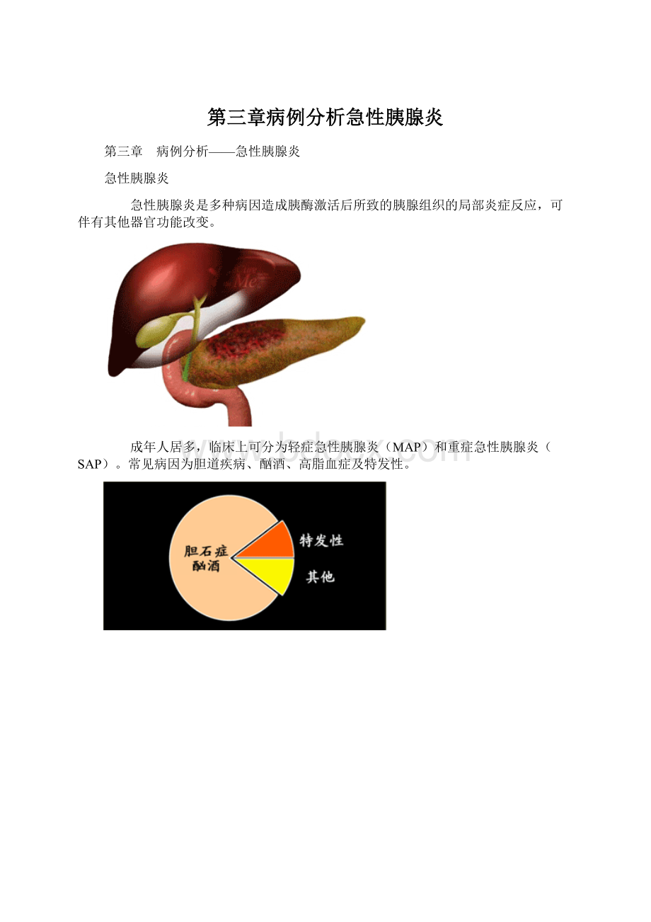 第三章病例分析急性胰腺炎.docx_第1页