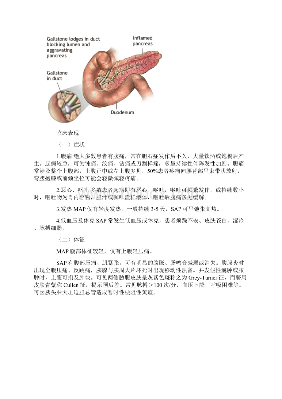 第三章病例分析急性胰腺炎.docx_第2页