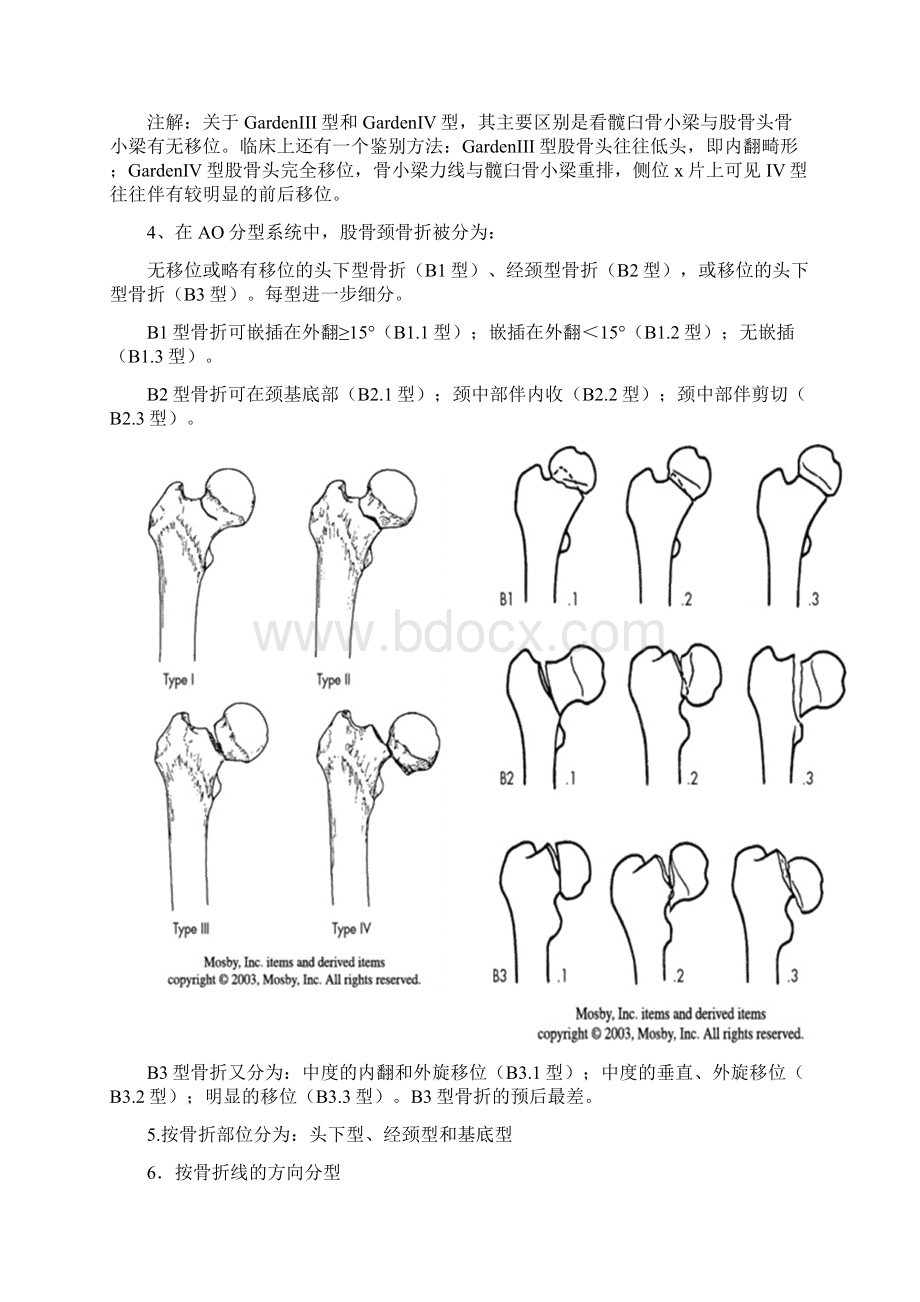 骨折分型.docx_第2页