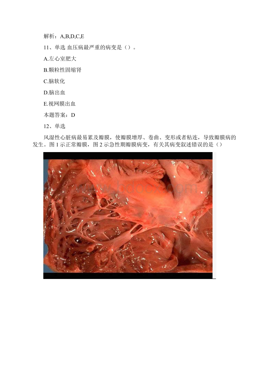 病理学医学高级心血系统疾病考试题库.docx_第3页