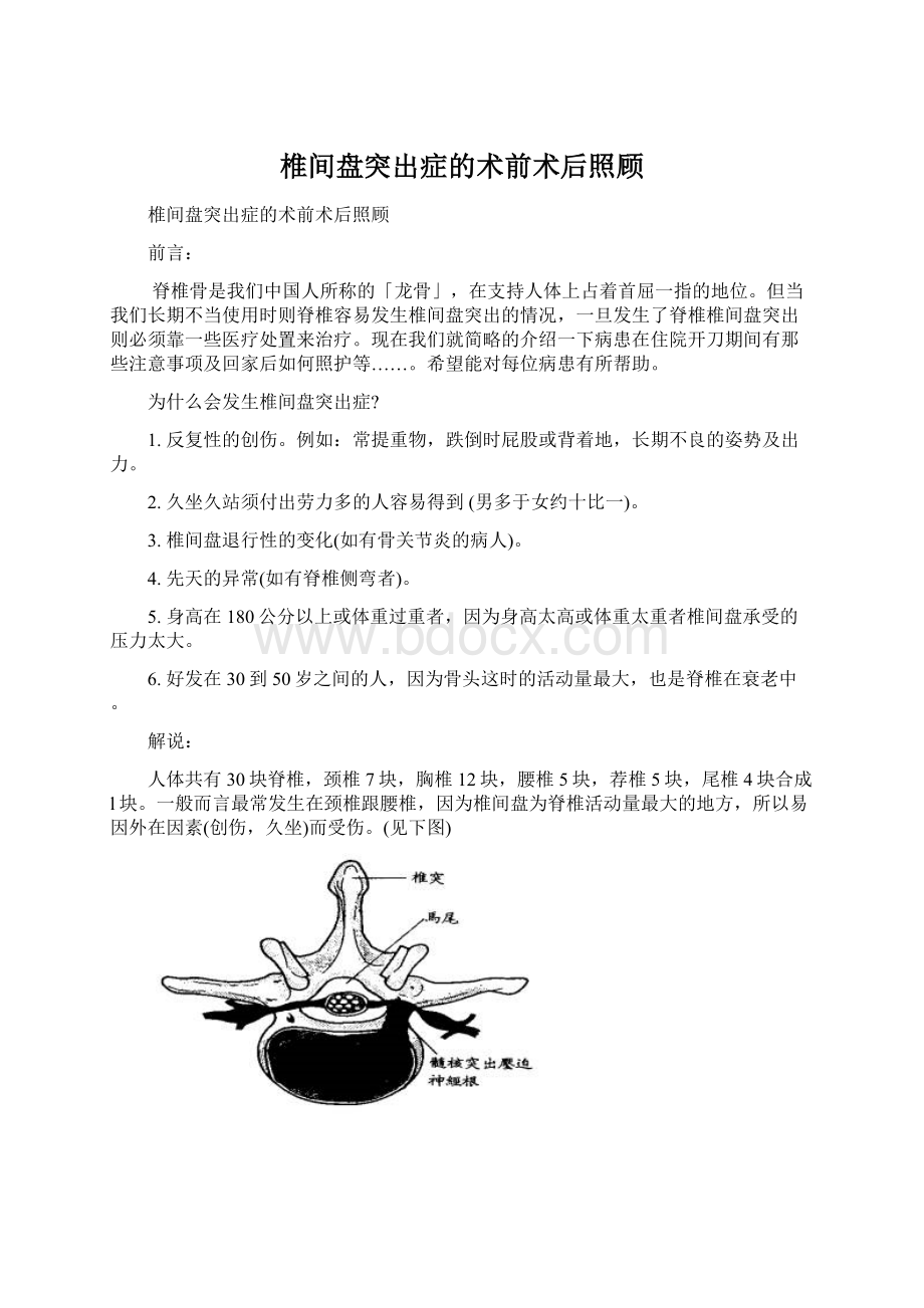 椎间盘突出症的术前术后照顾文档格式.docx