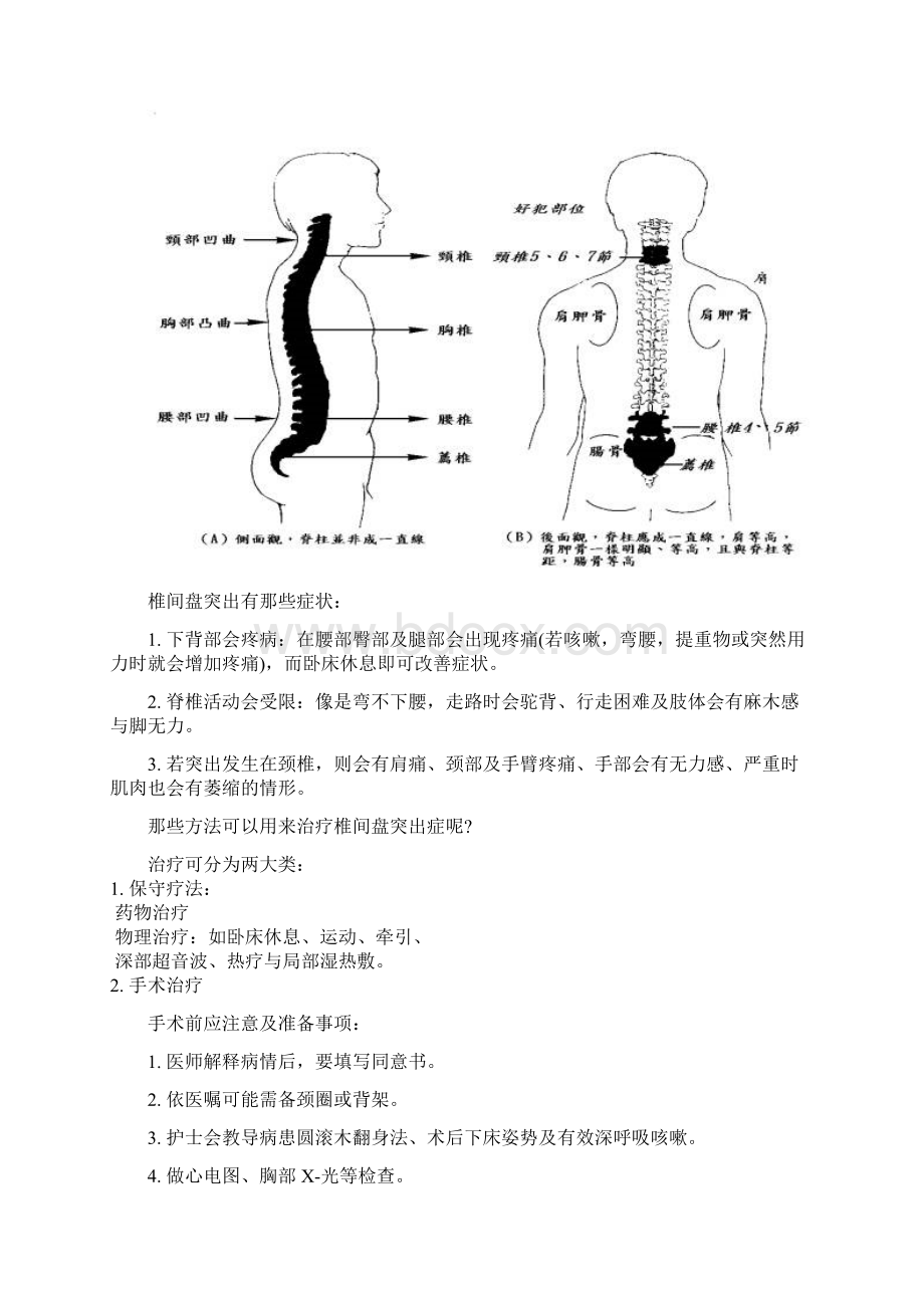 椎间盘突出症的术前术后照顾文档格式.docx_第2页