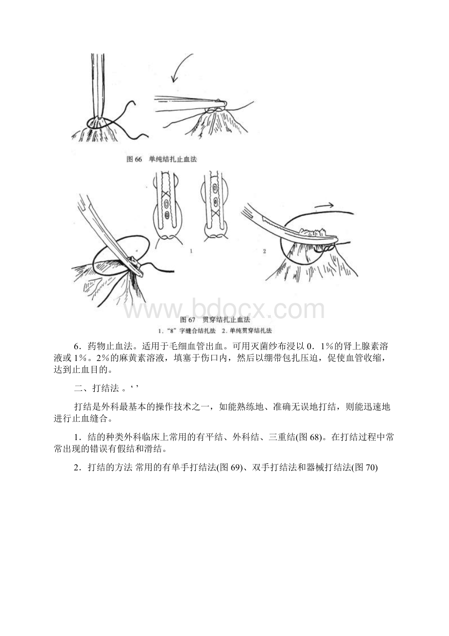 外科手术止血缝合打结及绷带技术图.docx_第2页