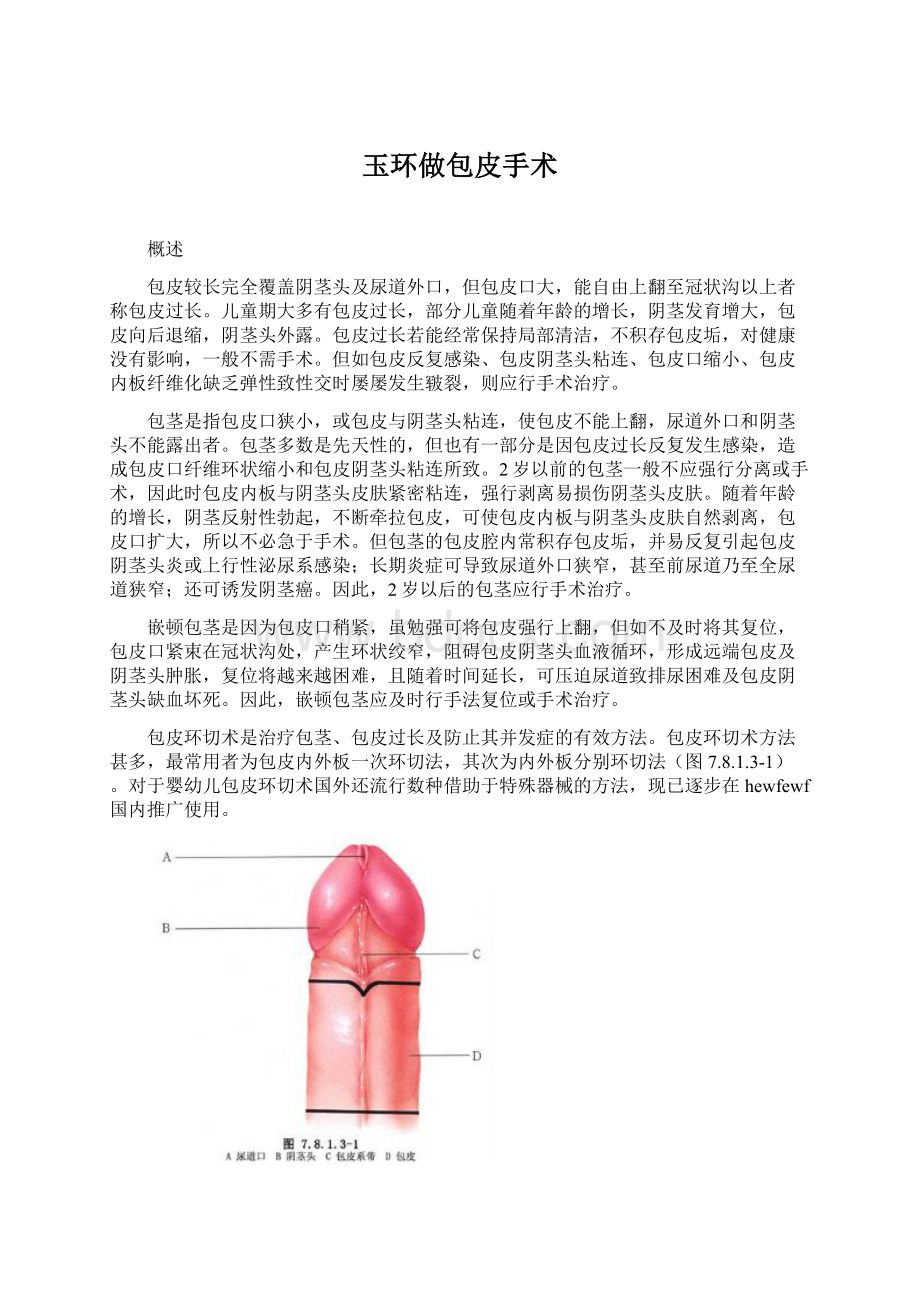 玉环做包皮手术.docx