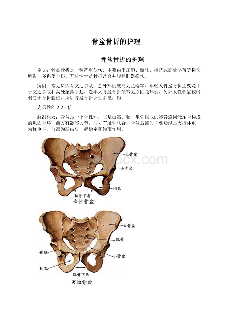 骨盆骨折的护理.docx