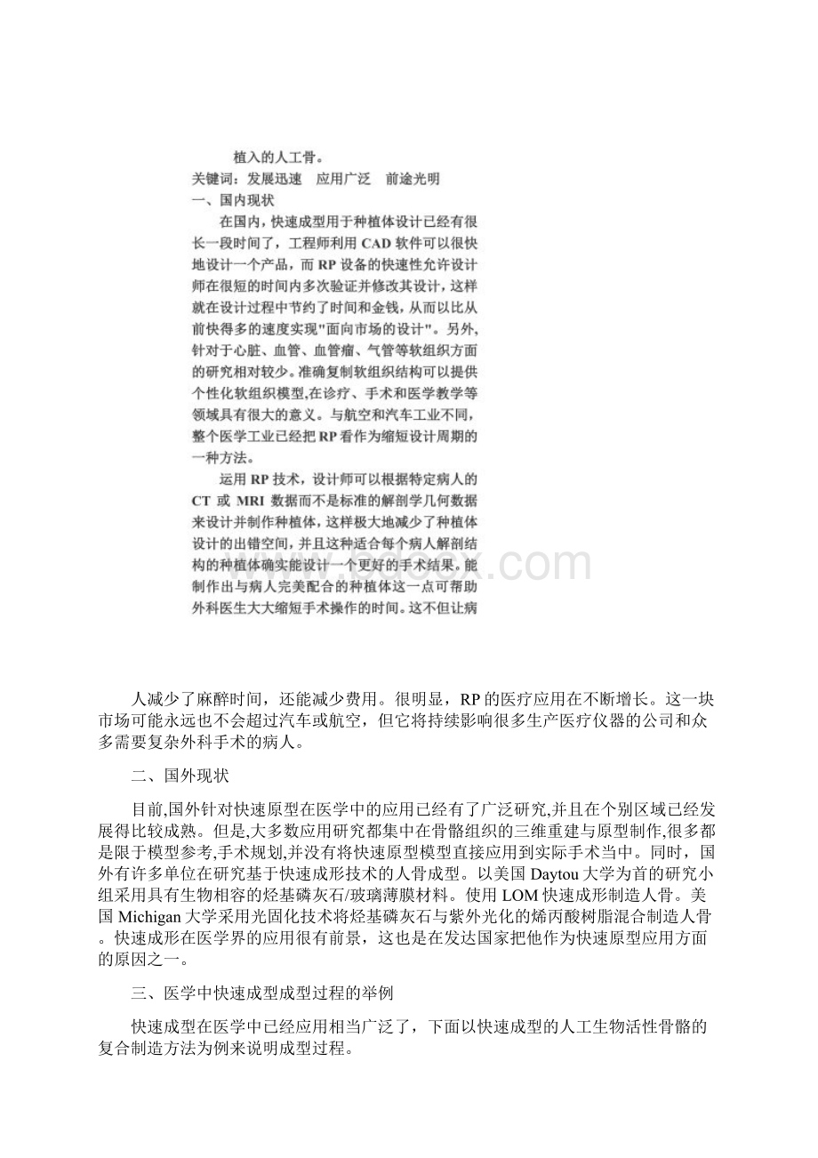 快速成型在医学中的应用.docx_第3页