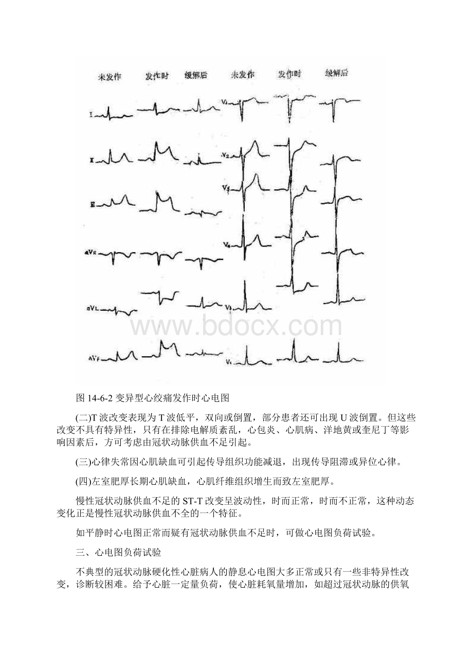 第六节 冠状动脉供血不足.docx_第3页