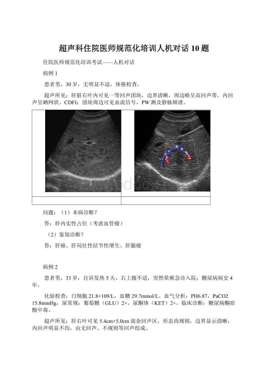 超声科住院医师规范化培训人机对话10题Word格式.docx