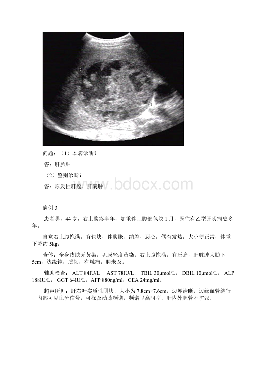 超声科住院医师规范化培训人机对话10题.docx_第2页