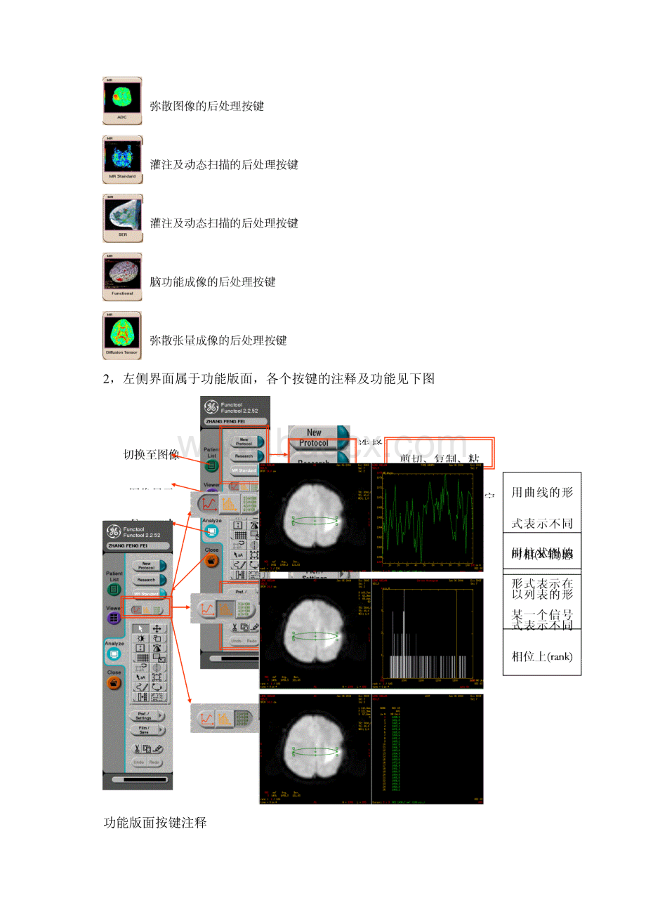 GET磁共振操作指南Functool文档格式.docx_第2页