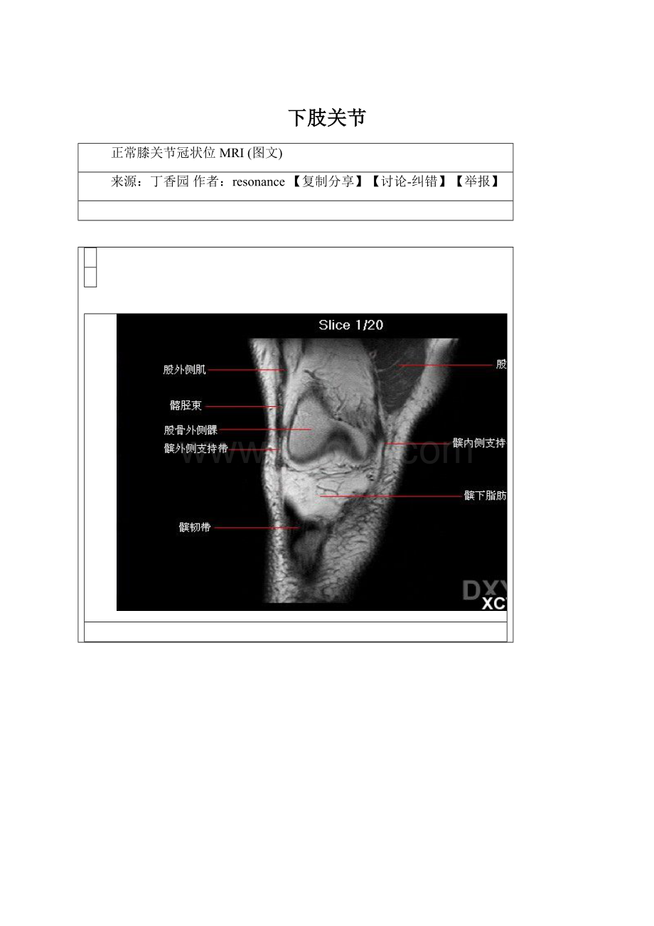 下肢关节.docx_第1页