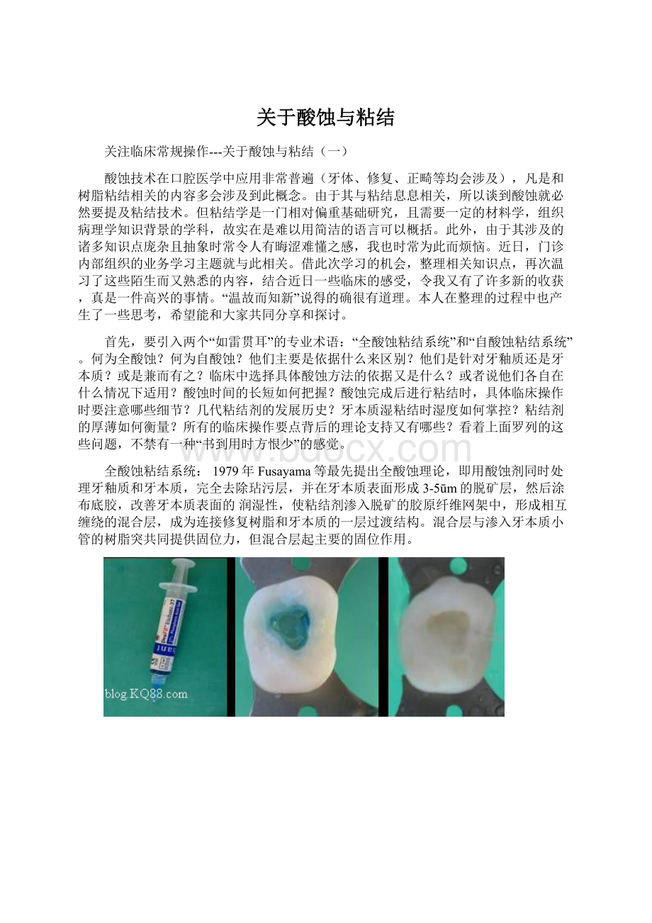 关于酸蚀与粘结Word下载.docx