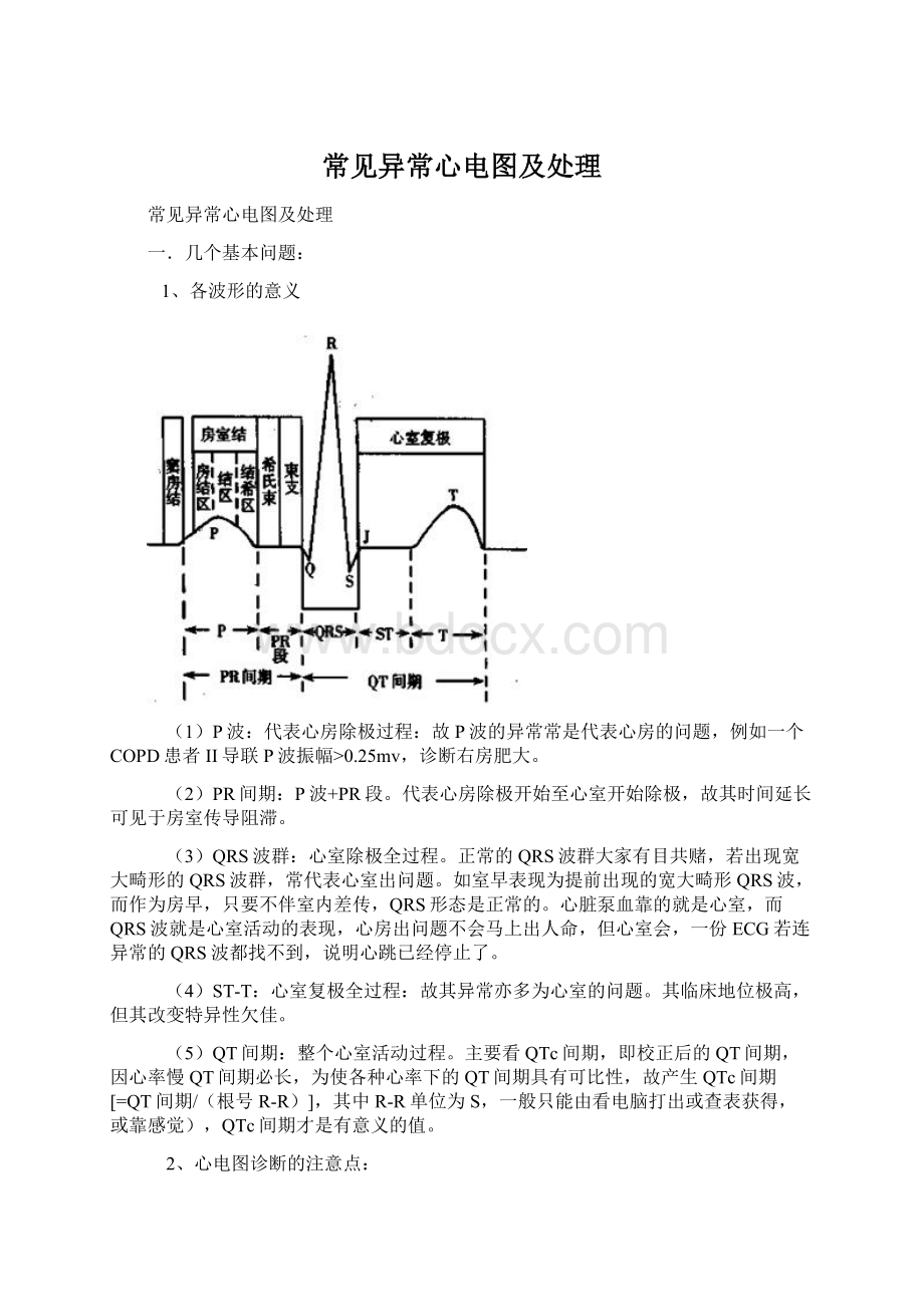 常见异常心电图及处理.docx