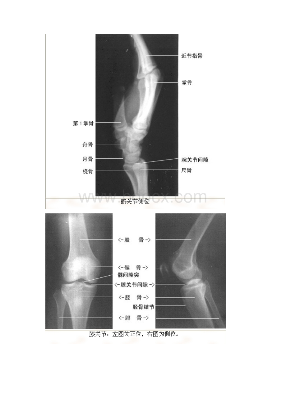 X线读片宝典绝版.docx_第3页