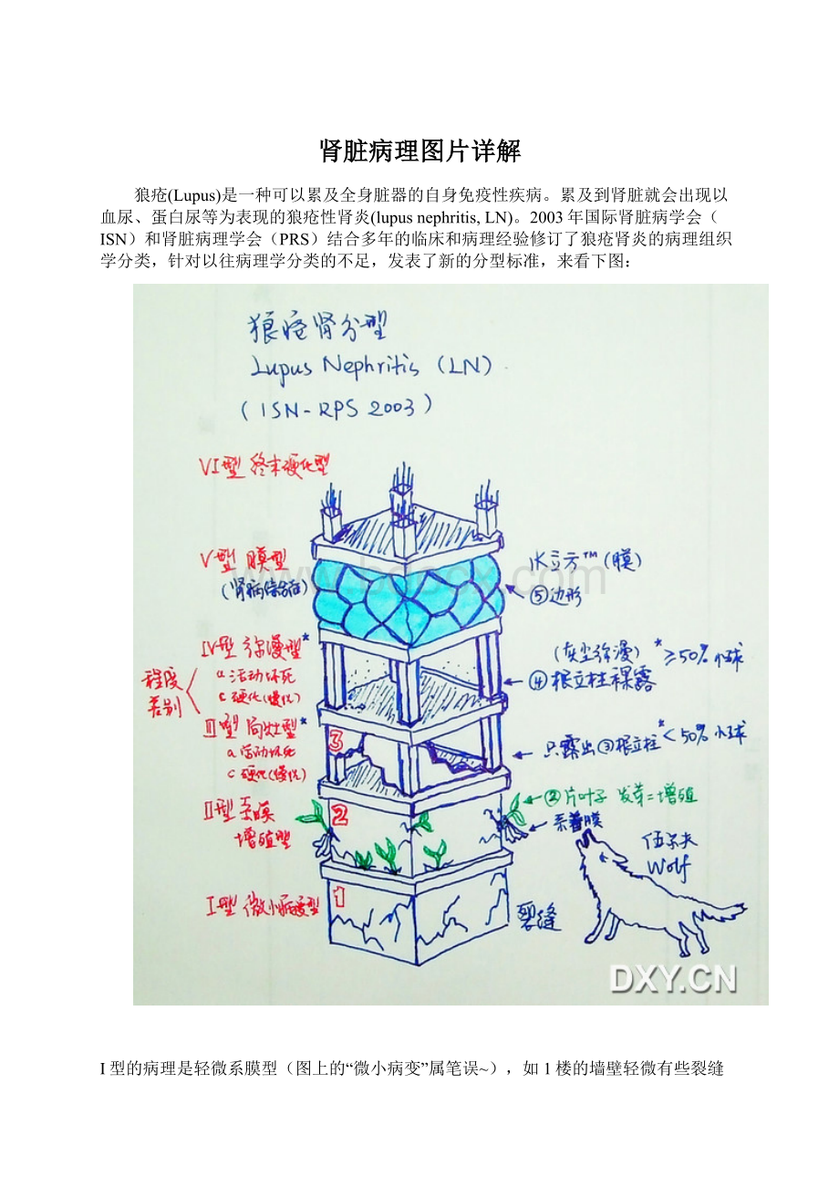 肾脏病理图片详解.docx