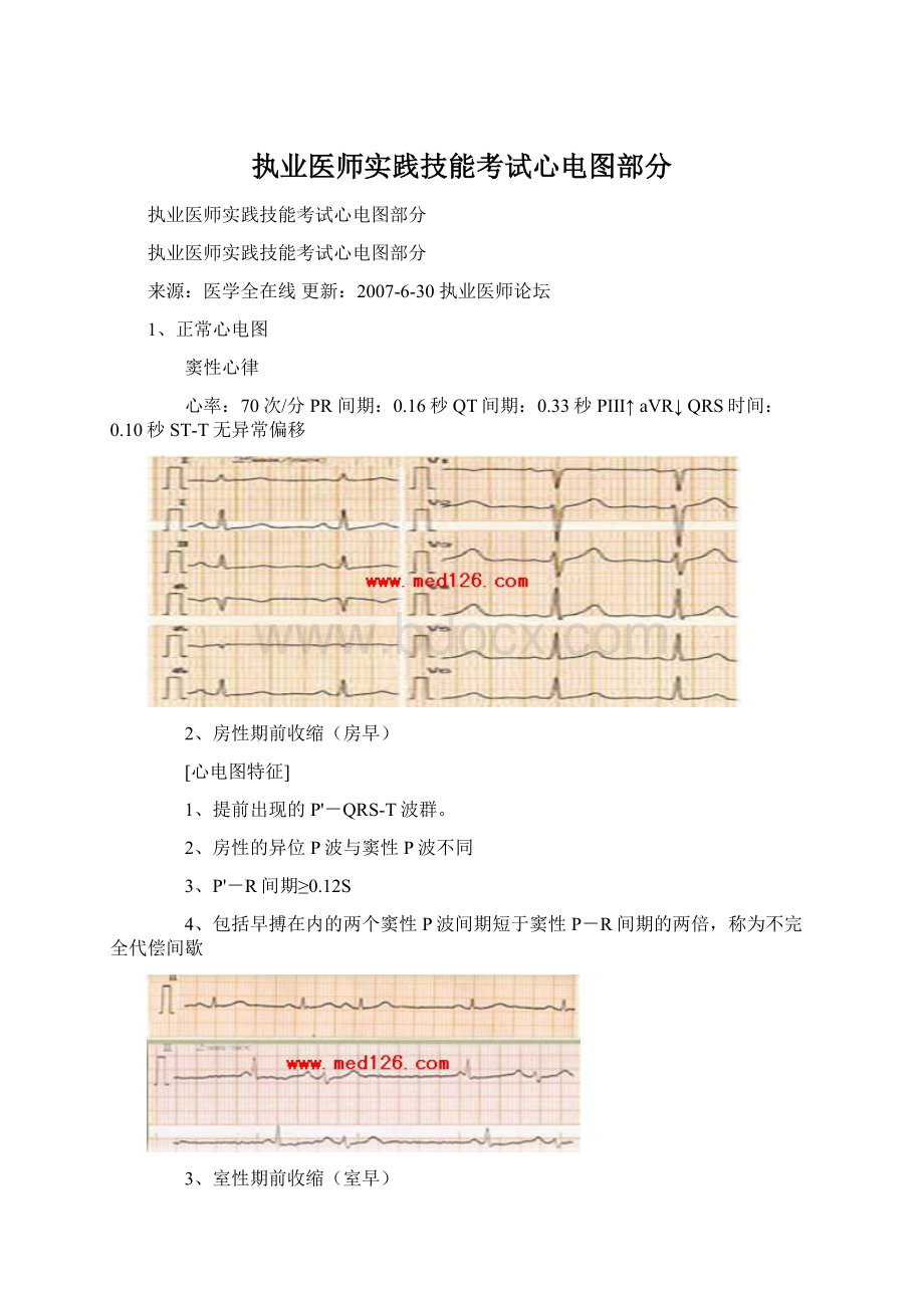 执业医师实践技能考试心电图部分.docx