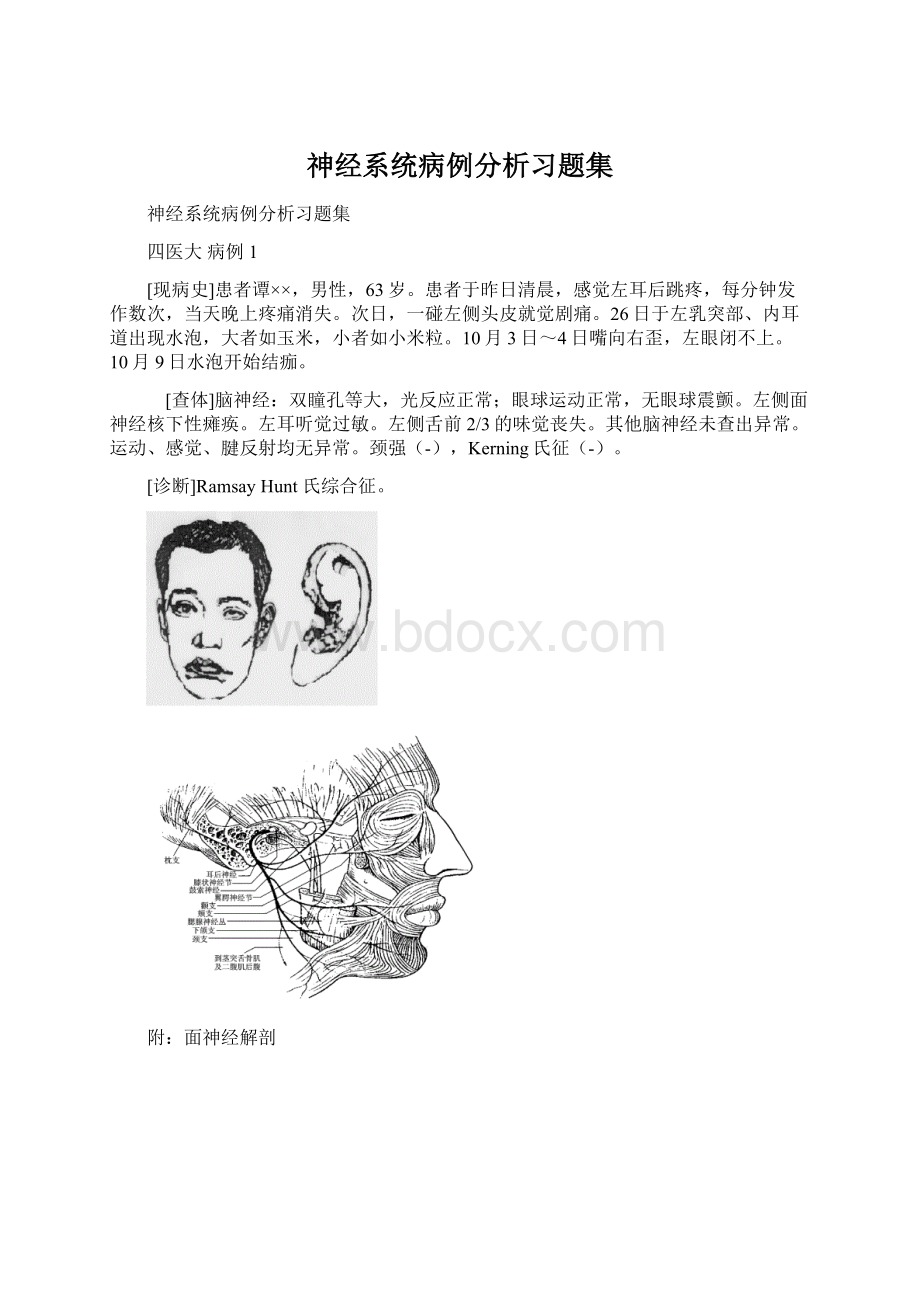 神经系统病例分析习题集Word格式文档下载.docx