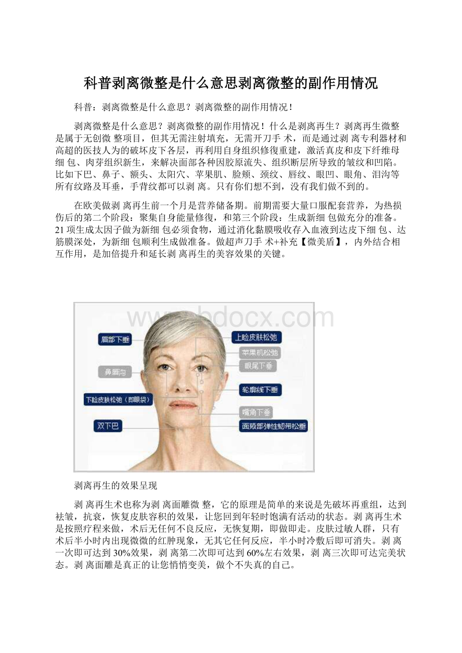 科普剥离微整是什么意思剥离微整的副作用情况.docx_第1页