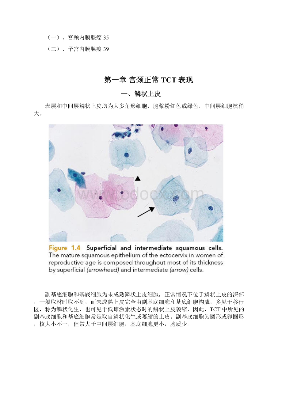 宫颈液基细胞学.docx_第2页