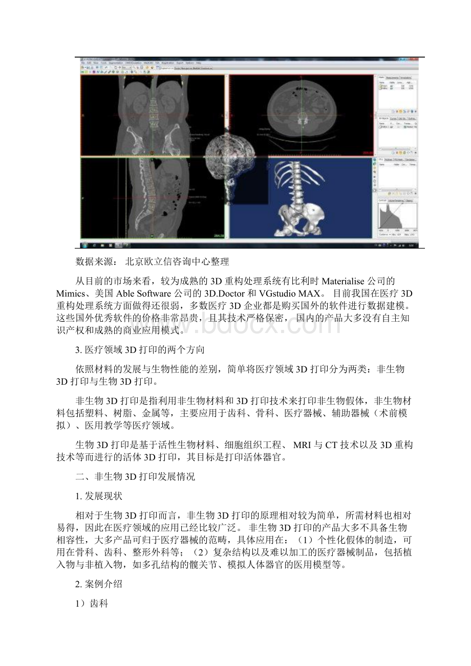 医疗领域3D打印行业市场分析报告.docx_第3页