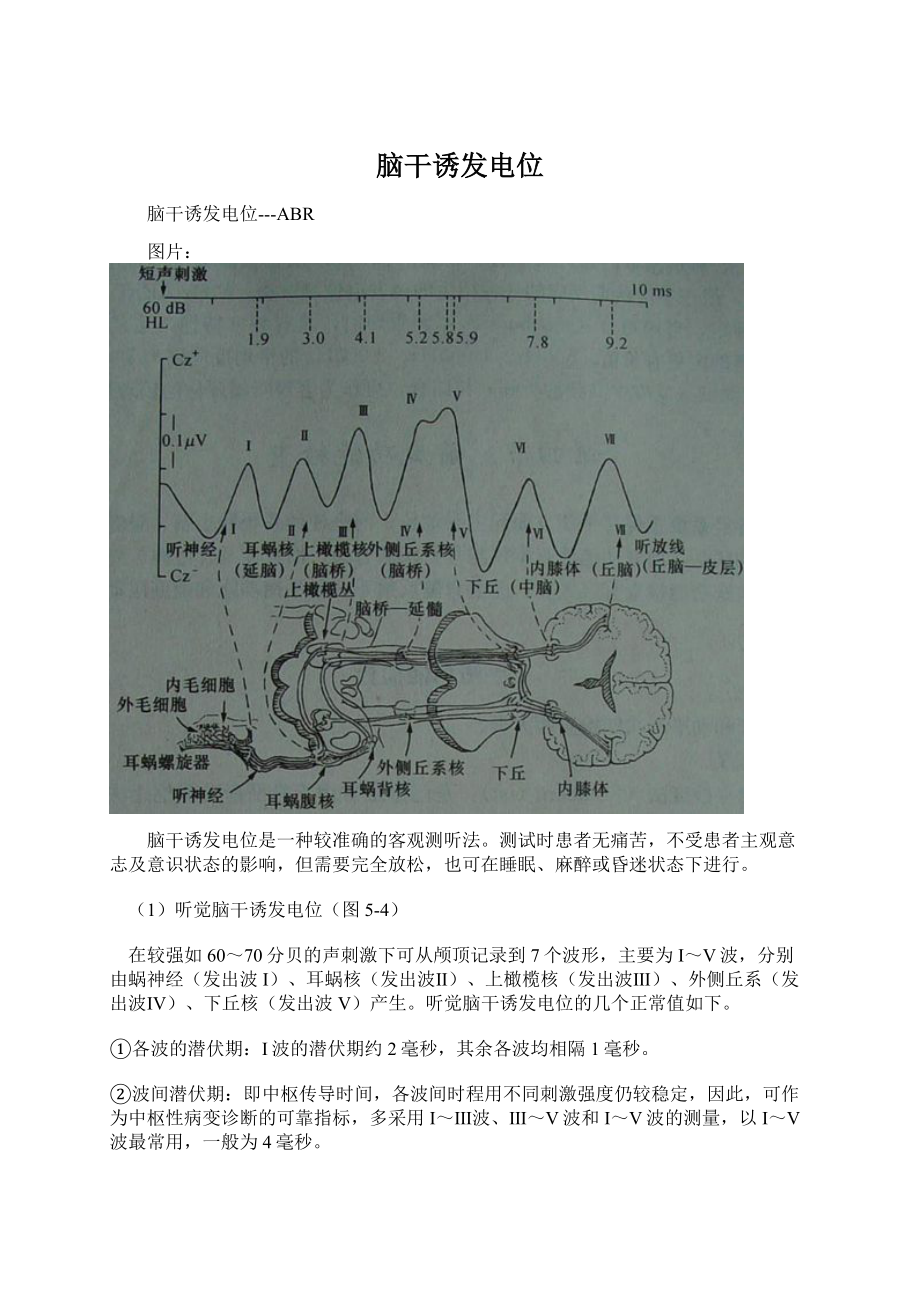 脑干诱发电位.docx