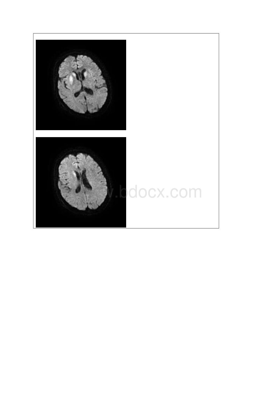 这是低血糖吗Word格式文档下载.docx_第2页