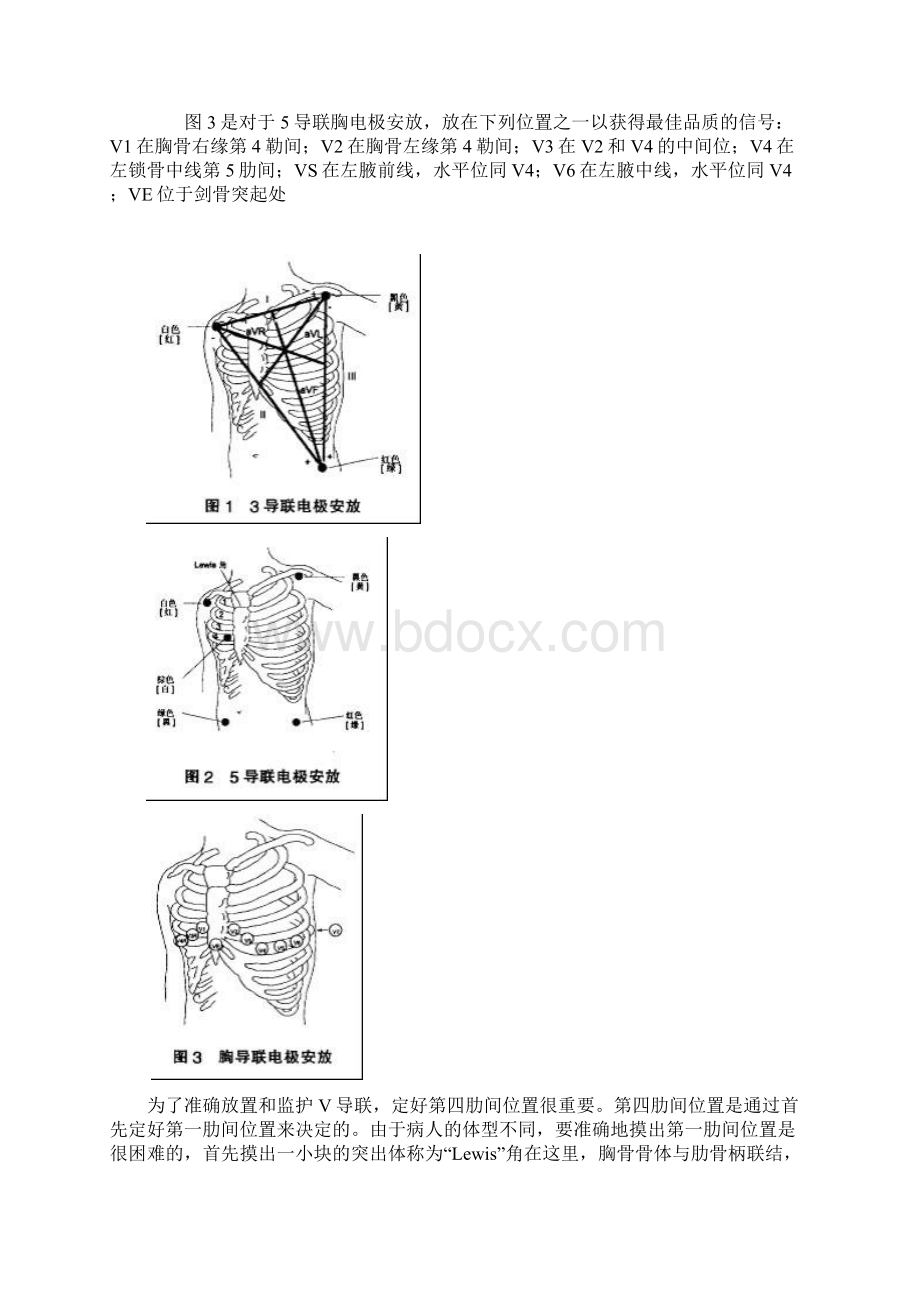 心电监护仪器的原理及使用毕业设计.docx_第3页