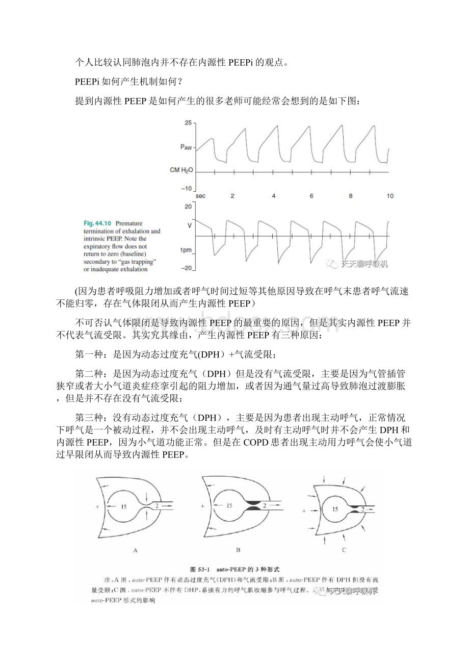 机械通气监测PEEPi内源性呼气末正压.docx_第2页