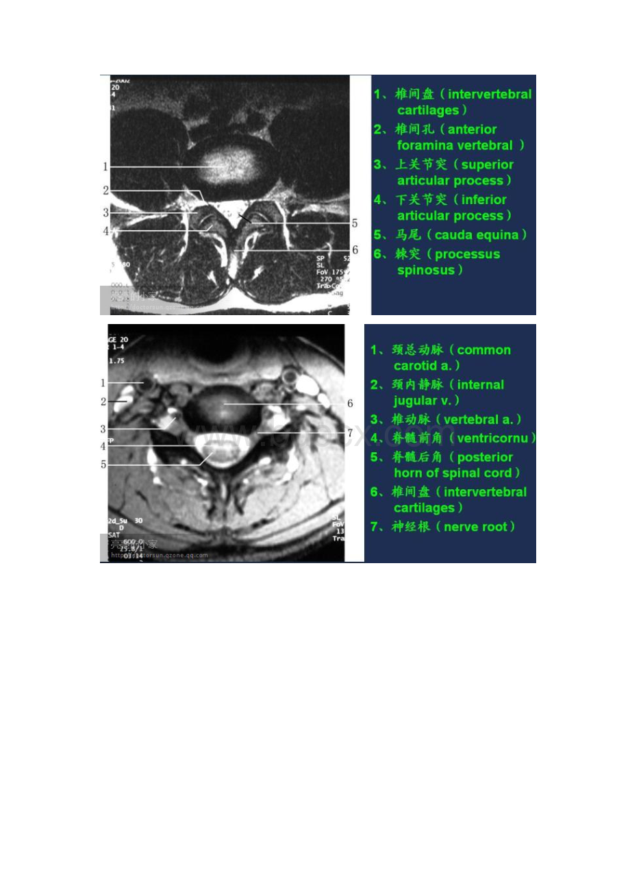 影像学片子.docx_第2页