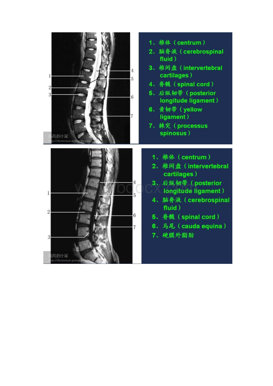 影像学片子.docx_第3页