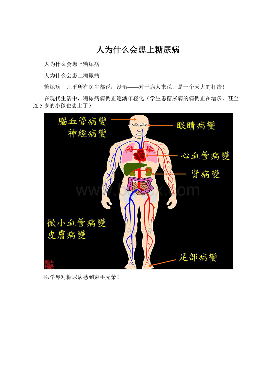 人为什么会患上糖尿病Word格式文档下载.docx_第1页