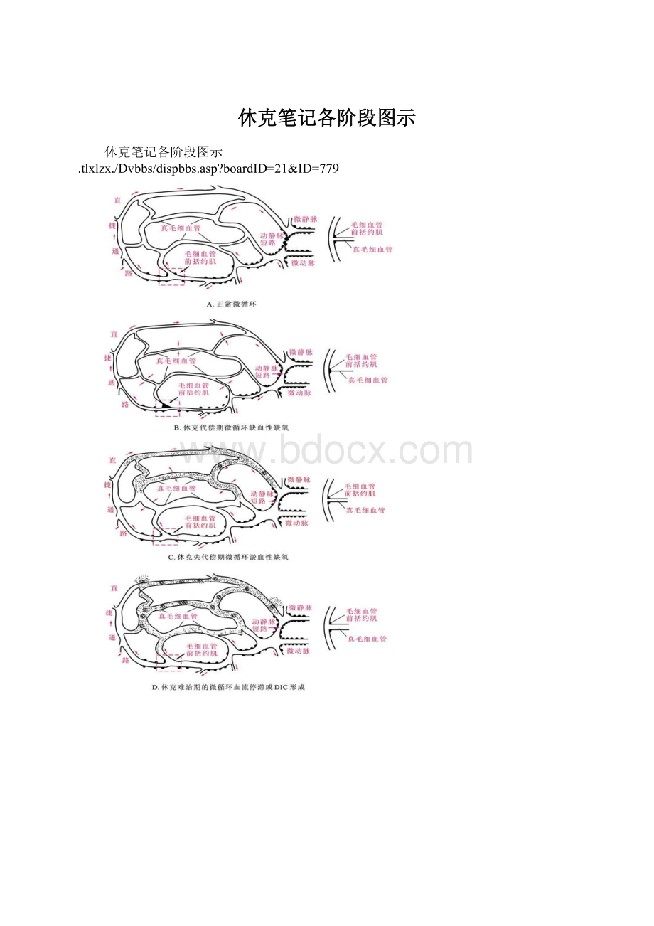 休克笔记各阶段图示.docx