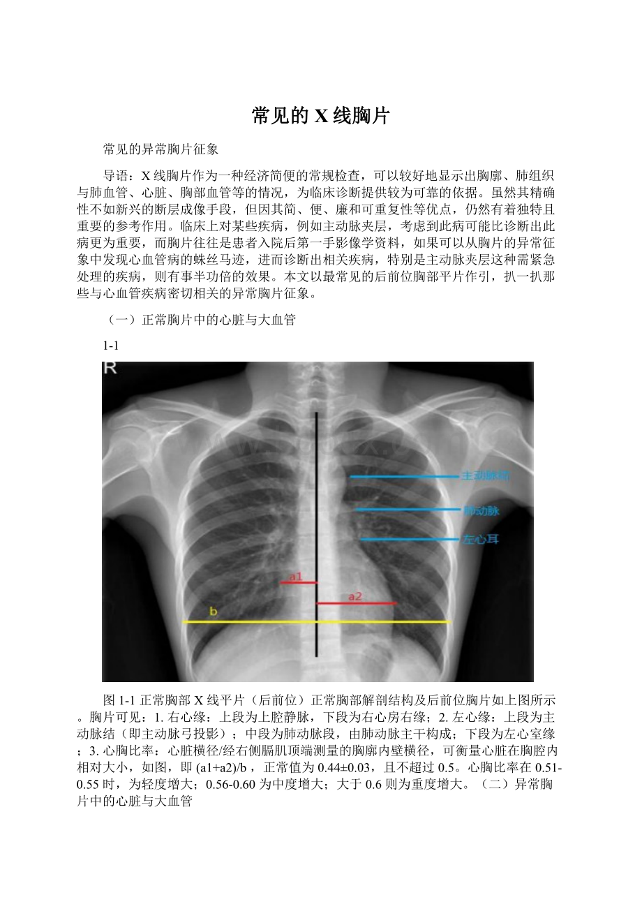 常见的X线胸片Word文件下载.docx