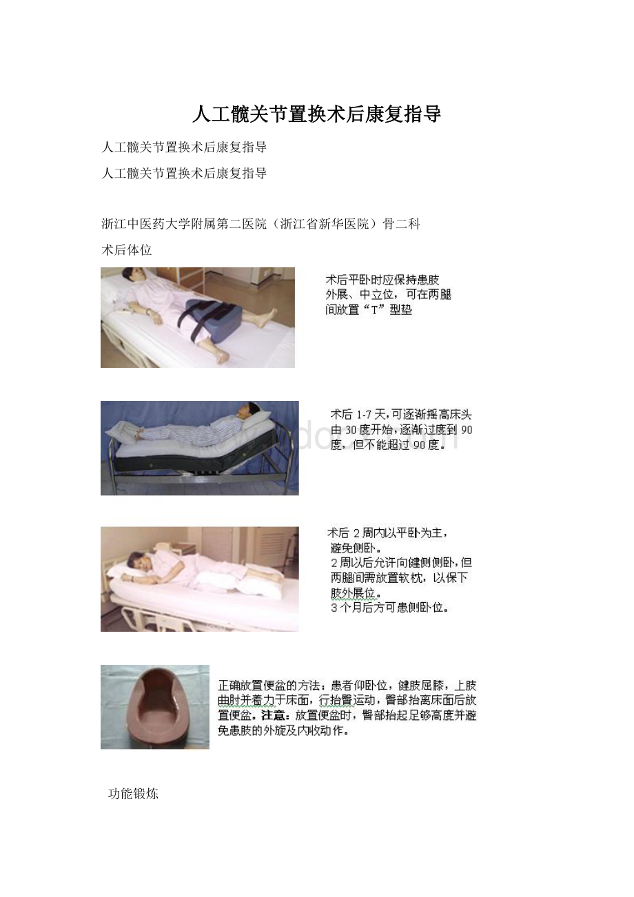 人工髋关节置换术后康复指导.docx_第1页