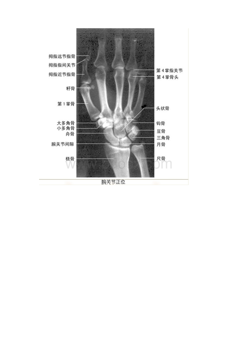 X线片系统读片原理.docx_第2页