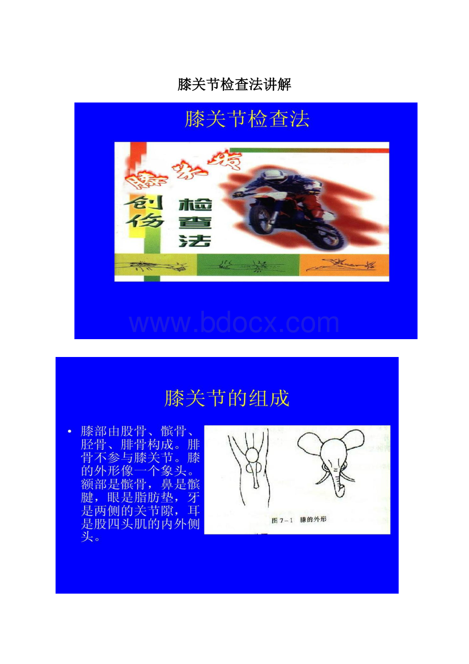 膝关节检查法讲解.docx