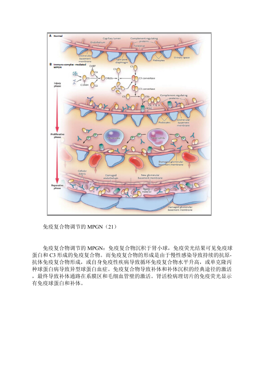 第五节 老年膜增生性肾小球肾炎段智宇.docx_第3页