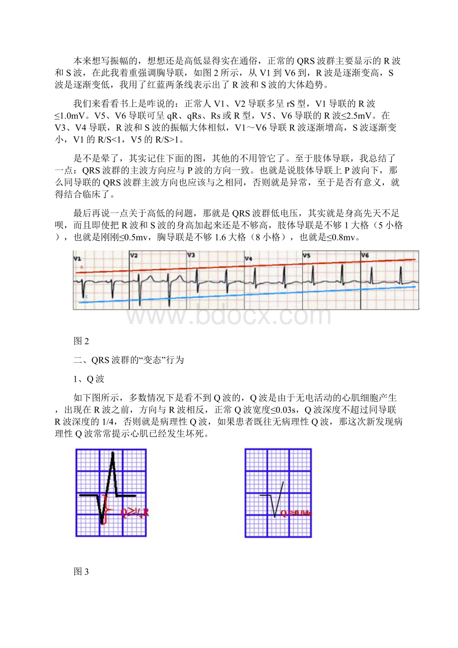 心电图QRS波群的五种.docx_第2页