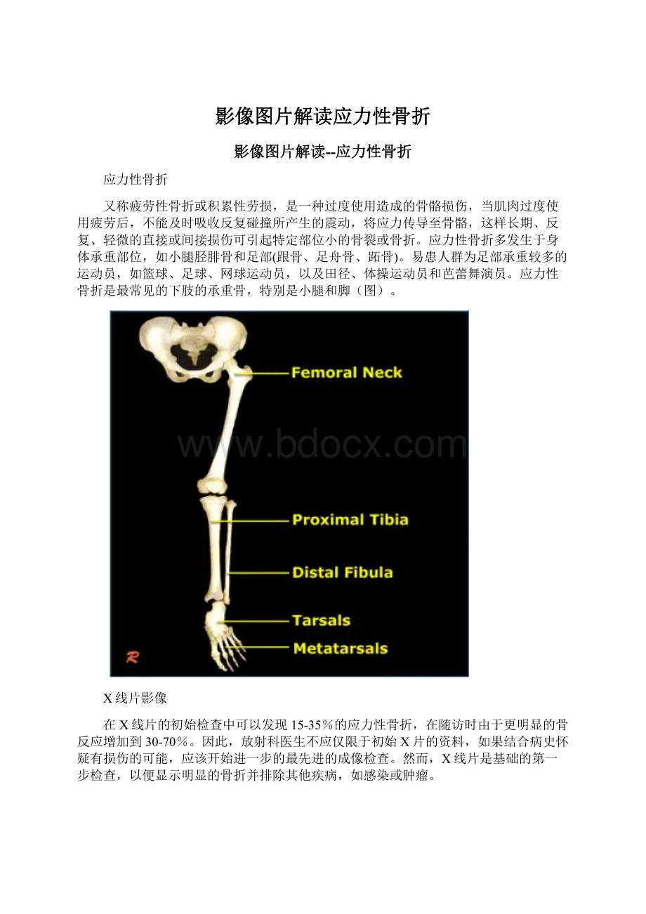 影像图片解读应力性骨折.docx