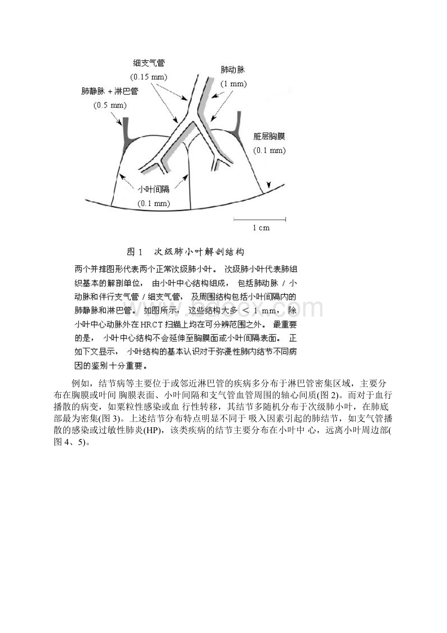 肺内多发结节的高分辨率CT鉴别诊断流程.docx_第2页