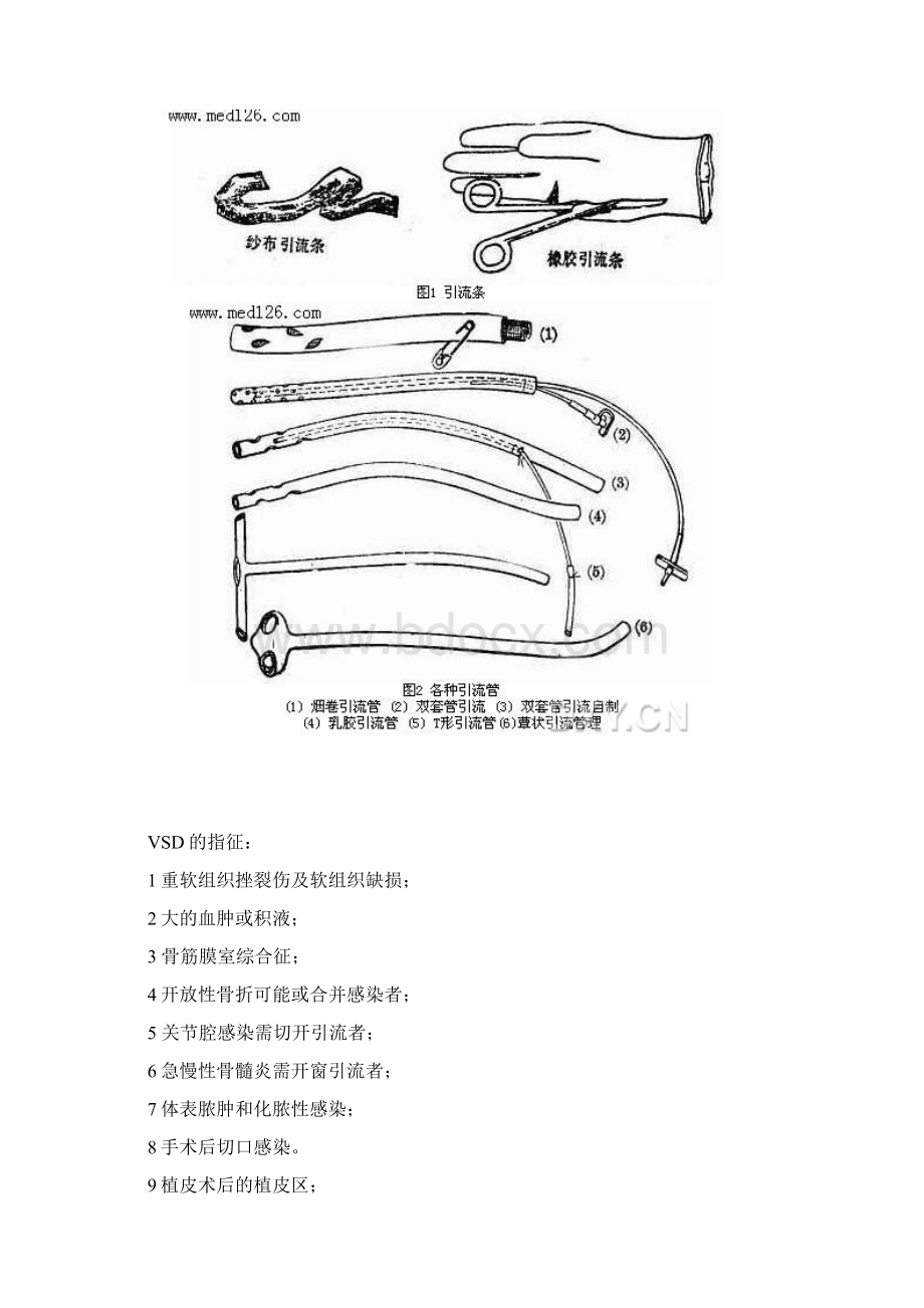 负压引流.docx_第3页