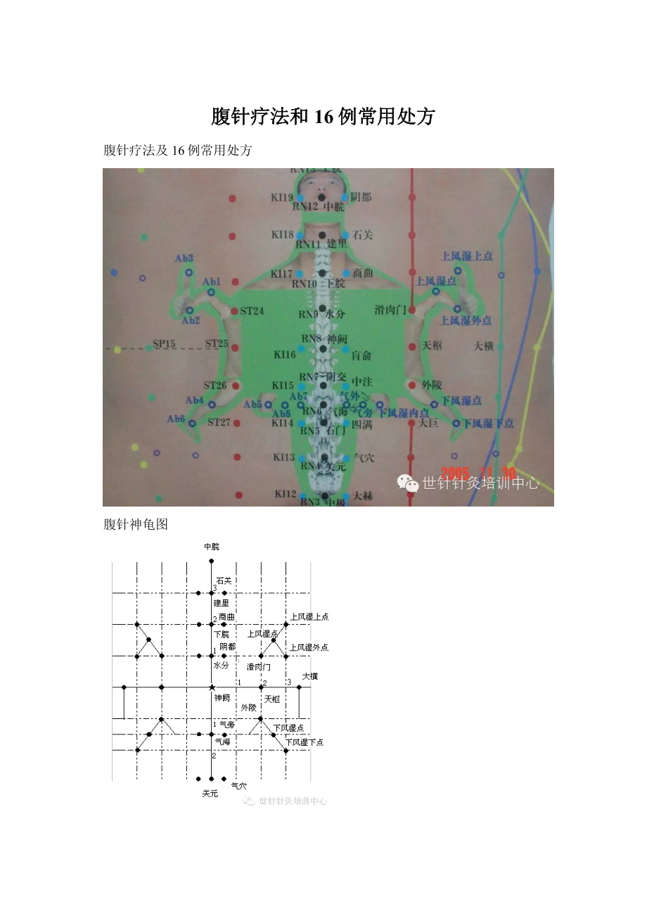 腹针疗法和16例常用处方Word下载.docx_第1页