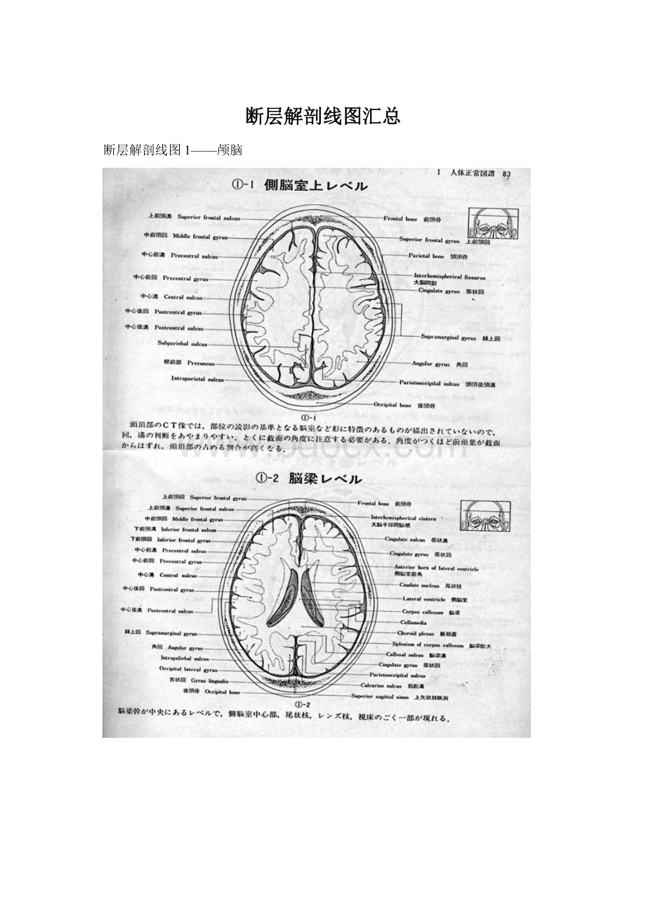 断层解剖线图汇总Word文档格式.docx