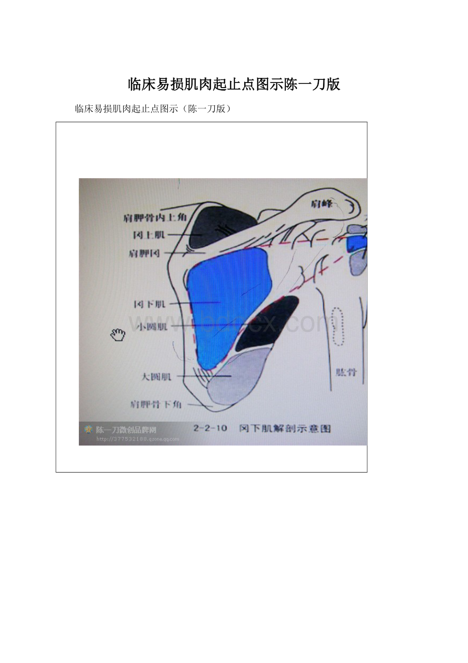 临床易损肌肉起止点图示陈一刀版文档格式.docx_第1页