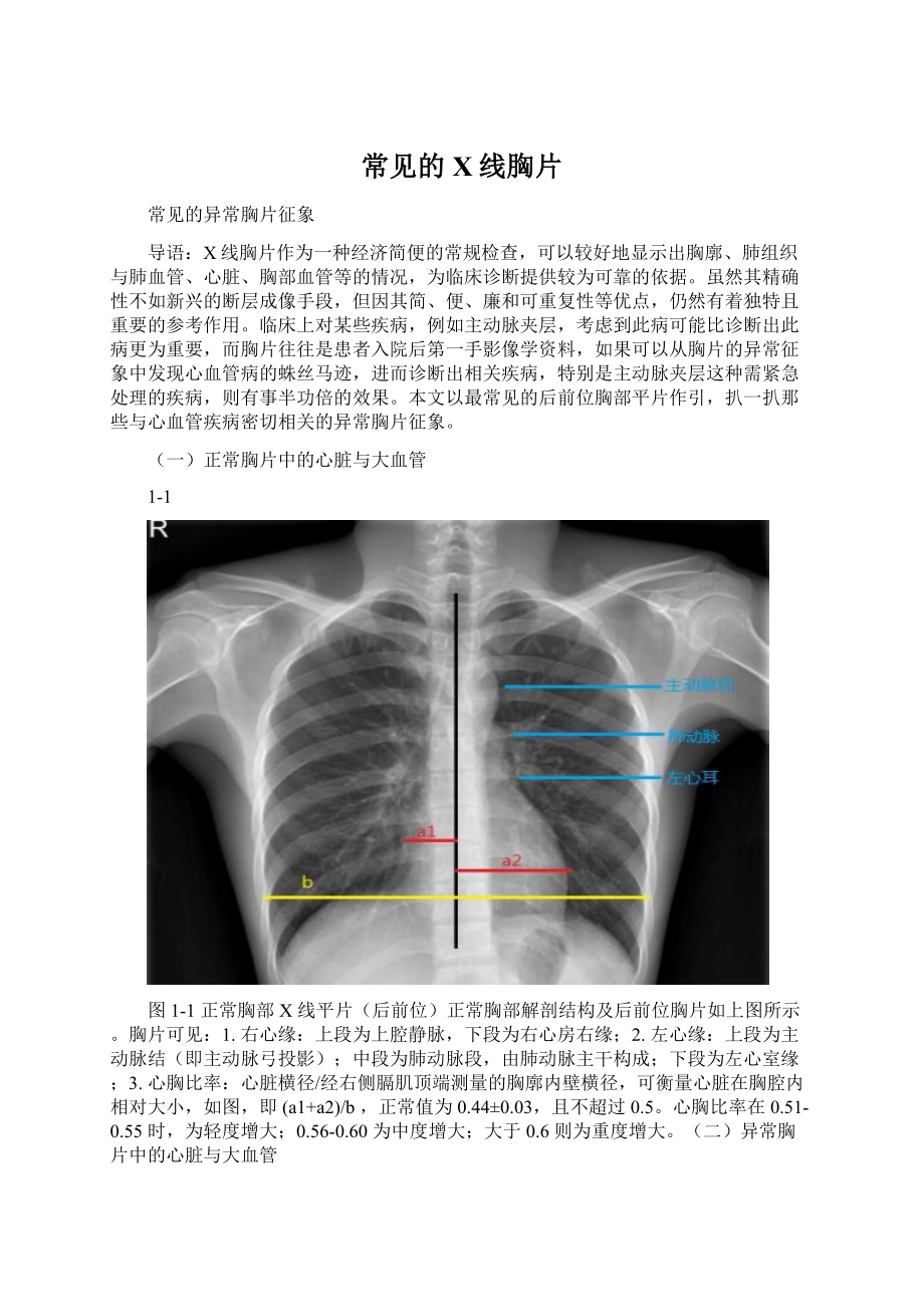 常见的X线胸片Word文档下载推荐.docx